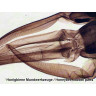 Набор микропрепаратов Bresser 100 шт., в кейсе 73765